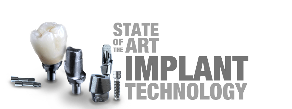 Implant crown, custom abutments and screws